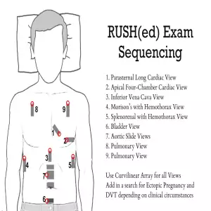 RUSH-ED-sequencing